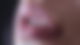 Lippen
